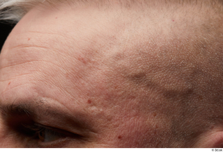 HD Face Skin Yury face forehead skin pores skin texture…